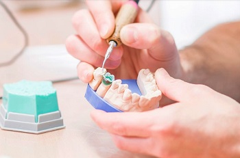Протезирование зубов: технология, подготовка и уход