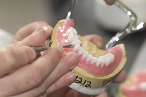 Протезирование зубов: правила и этапы