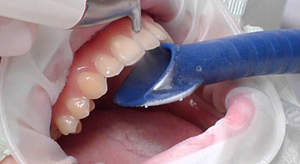 ��� �������� �������������� ������ ����� � ��� ����� � ����� ������